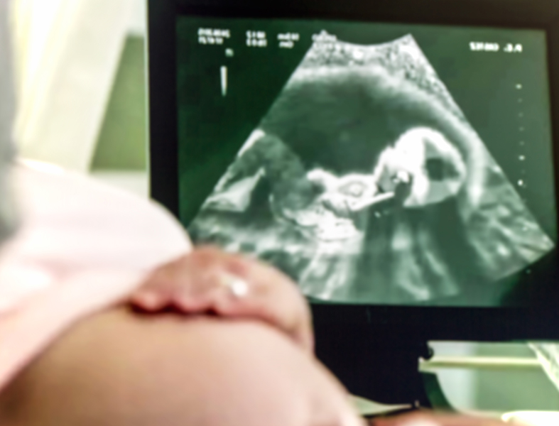 pregnant woman having 4D ultrasound scan